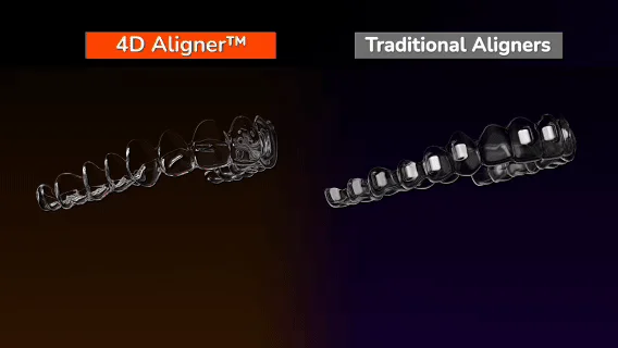 No-Attachment-1 - 4D Aligner